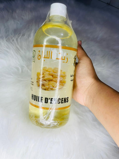 Frankincense oil(20ml) for skin care Reduces wrinkles and fine linesIIFades scars and stretch marks